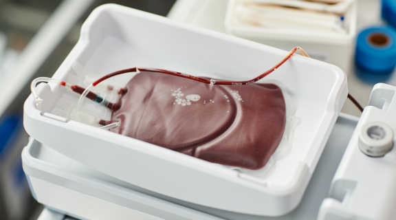 Quanto de sangue é retirado na doação? Saiba como o corpo reage