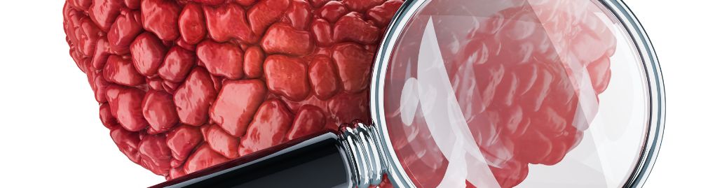 quanto tempo de repouso após cirurgia de tireoide1.jpg