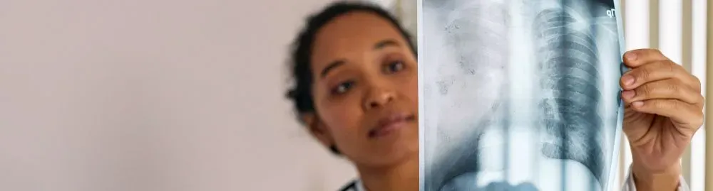 radiografia de tórax1.webp