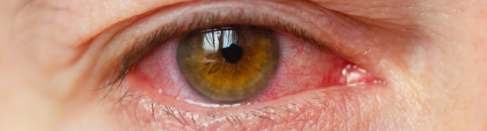 retinopatia diabética1.jpg