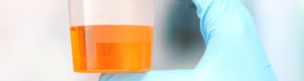 sangue na urina feminina_1.jpg