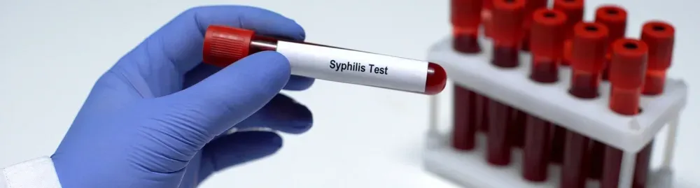 sífilis como pega​1.webp