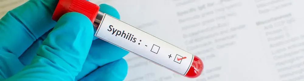 sífilis sintomas em homem1.webp