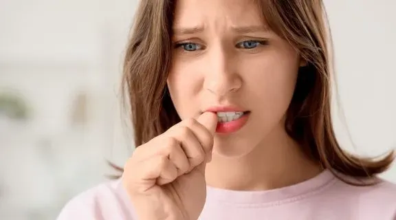 Candidíase oral: sintomas e tratamentos indicados para o ‘sapinho’ na boca