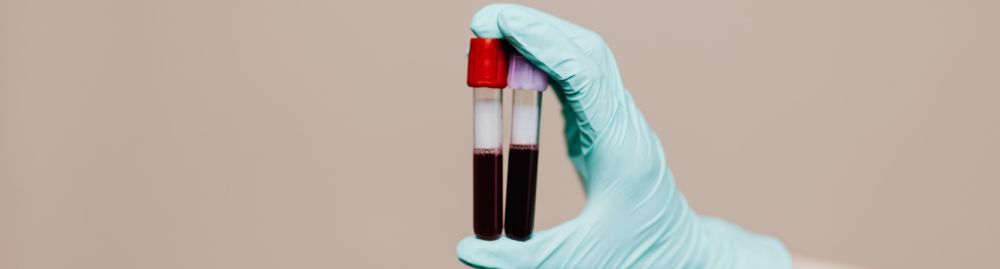 sintomas de cortisol baixo1.jpg