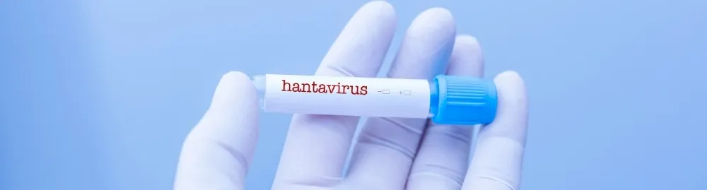 sintomas de hantavírus_1.webp