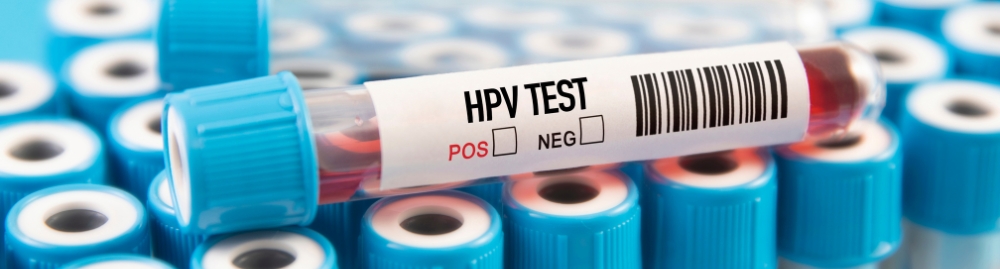 tenho hpv posso ter relações1.jpg