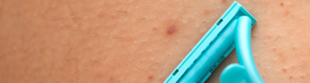 tipos de foliculite_1.jpg