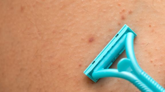 Tipos de foliculite: como identificar e diferenciar as inflamações na pele