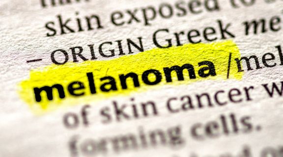 Quais são os tipos de melanoma e como diferenciá-los entre si? Veja sinais