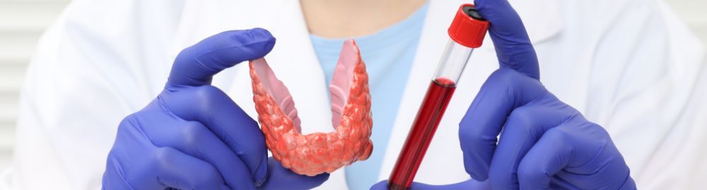 tireoidite de hashimoto com tsh normal​1.jpg