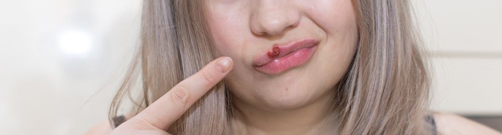 tratamento hpv na boca1.jpg