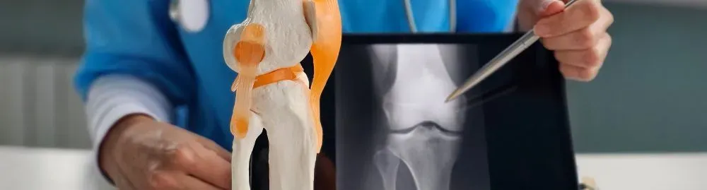 tratamentos para osteopenia_1.webp