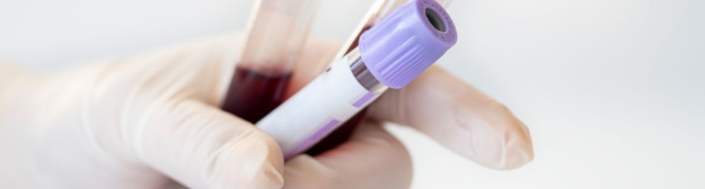 trombofilia adquirida1.jpg