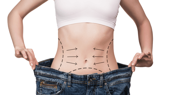Cirurgia plástica depois de emagrecer
