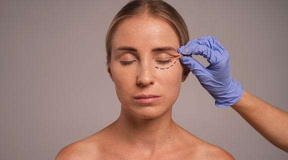 blefaroplastia