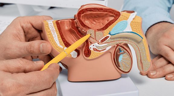 câncer de próstata