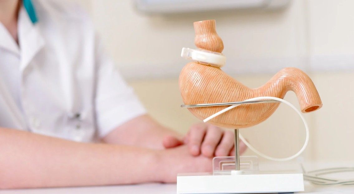 cirurgia bariátrica bypass.jpg