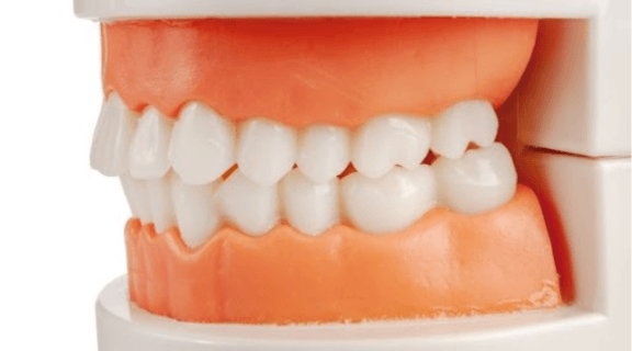 cirurgia ortognática​.png