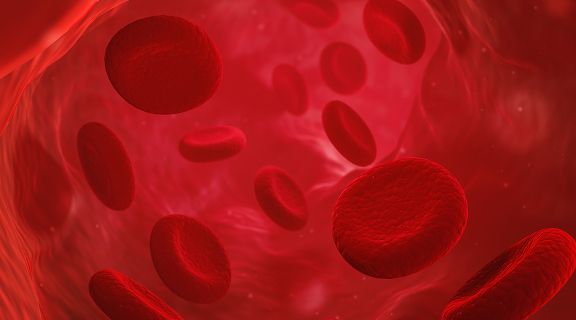 o que é mielodisplasia