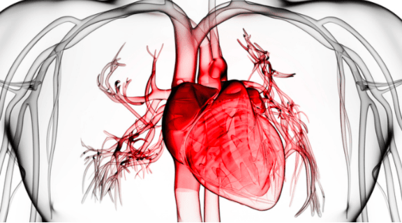 sinais de infarto.png