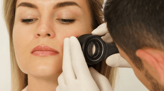 sintomas de câncer de pele no rosto