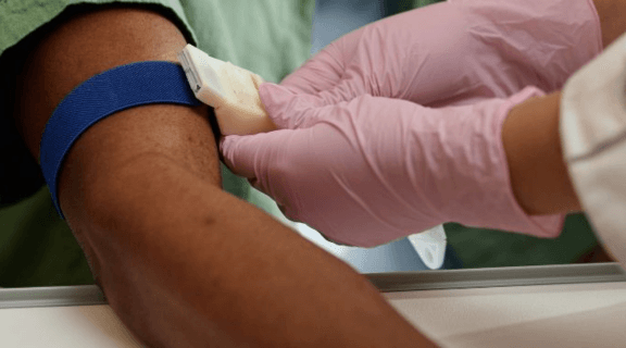 sintomas de hemofilia