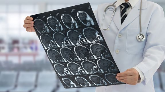 médico observando resultado de tomografia